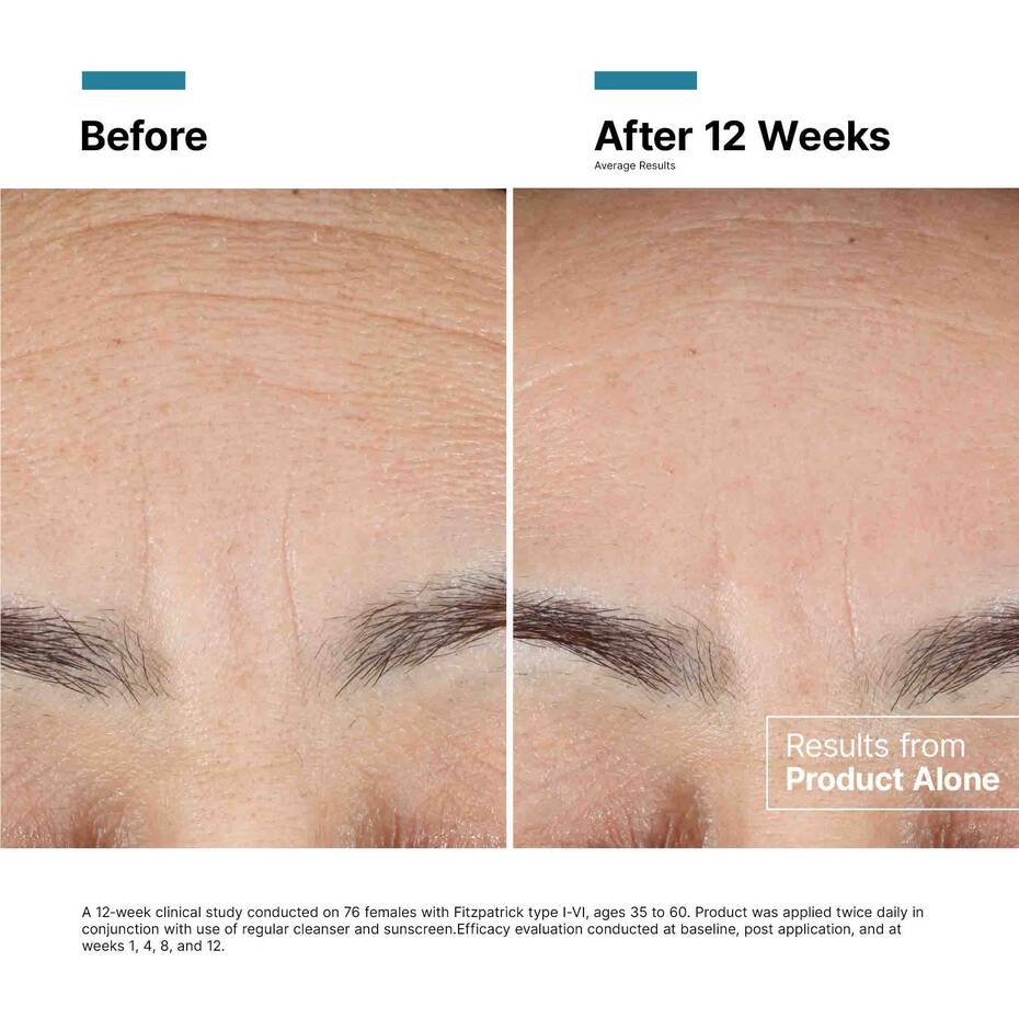 SkinCeuticals Advanced RGN-6